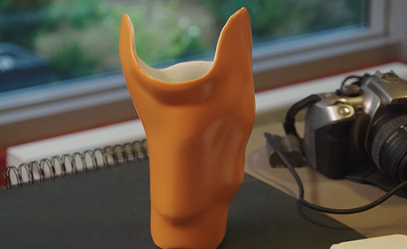 Ontdek meer over het 3D printen van prothesen bij Landré